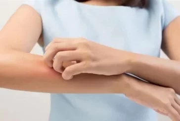 الحكة علامة على الإصابة بالسرطان أيضاً