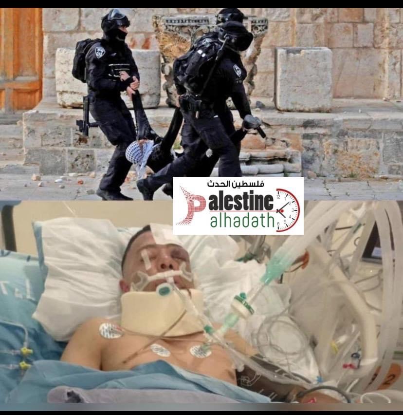 استشهاد الشاب وليد الشريف متأثرا بإصابته برصاص الاحتلال بشهر رمضان في المسجد الأقصى