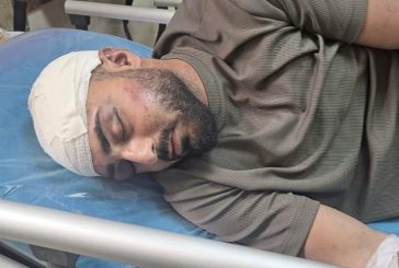 اريحا-إصابة شاب من بتير باعتداء جنود الاحتلال في العوجا
