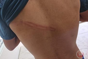 مستوطنون يعتدون على فتيين ويسرقون مبلغا غرب سلفيت