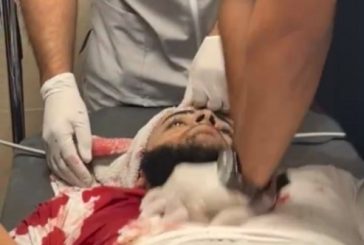 مستعربون يغتالون مواطنا في جنين