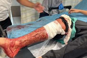 5 اصابات في هجوم للمستوطنين على خلة النحلة جنوب بيت لحم
