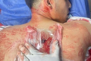 اصابة شاب برصاص جيش الاحتلال في الخليل