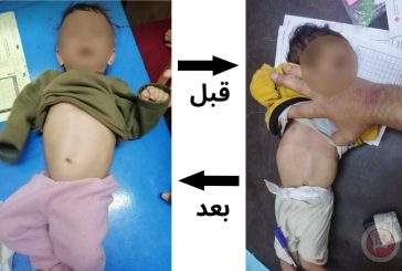 الهلال الأحمر الفلسطيني ينقذ: صور نجاحات في مكافحة سوء التغذية