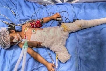 الأمم المتحدة: 70% من ضحايا العدوان على غزة هم من الأطفال والنساء