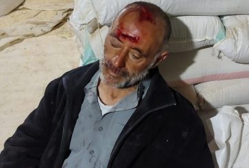 إصابة مسن بعد اعتداء مستوطنين عليه جنوب الخليل