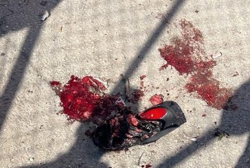 اعتقال شاب بعد اطلاق النار عليه في نابلس