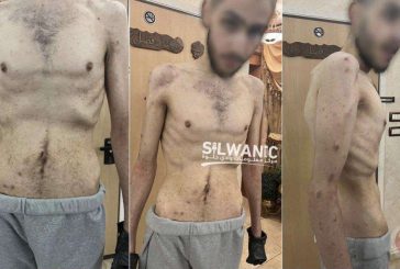 مركز حقوقي: السجون الإسرائيلية قبور للأحياء