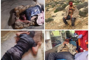 إصابة 5 مواطنين خلال اعتداء المستوطنين على رعاة الأغنام في مسافر يطا