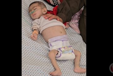 استشهاد طفلة في غزة بسبب المجاعة ما يرفع الحصيلة إلى 54