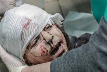 1500 مواطنا بغزة فقدوا البصر بسبب الحرب