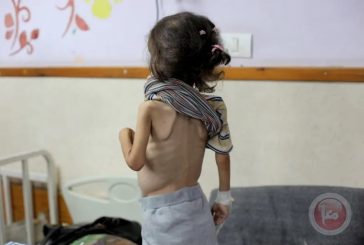 ألبانيز لأهل غزة: جوعكم عار علينا