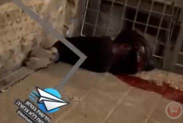 استشهاد المنفذ-إصابة شرطي إسرائيلي بعملية طعن على ابواب الاقصى