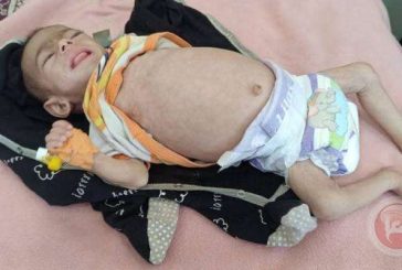 تقرير حقوقي يوثق الارتفاع الحاد بمعدلات الوفاة الطبيعية في قطاع غزة