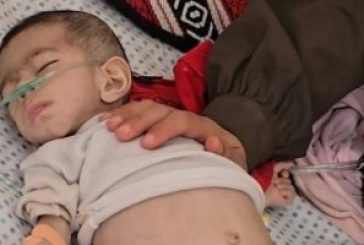 بسبب المجاعة: وفاة طفلة في مدينة خان يونس