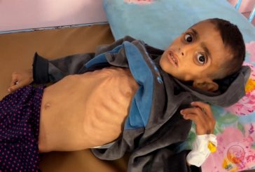المجاعة في غزة تتسبب بتراجع الدعم في امريكا لاسرائيل