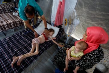 18 وفاة خلال 24 ساعة بسبب الجوع في غزة