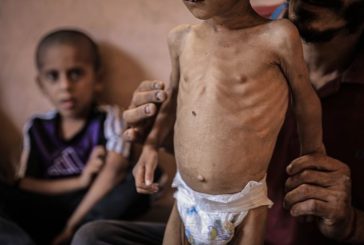 منظمة العفو الدولية تتهم إسرائيل بسياسة تجويع متعمدة في غزة