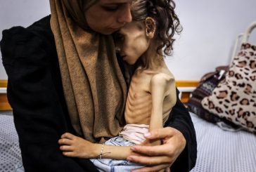 بينهم طفل- 11 حالة وفاة جديدة نتيجة المجاعة وسوء التغذية بغزة