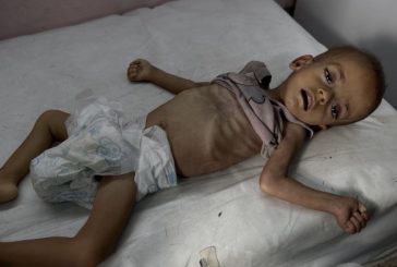 4 حالات وفاة جديدة نتيجة المجاعة وسوء التغذية بغزة خلال 24 ساعة