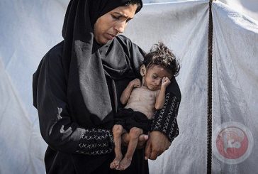 تسجيل 5 حالات وفاة جديدة نتيجة سوء التغذية في قطاع غزة