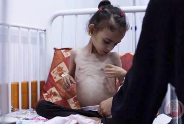 خمسة ضحايا جدد نتيجة الجوع في قطاع غزة يرفع الحصيلة إلى 162