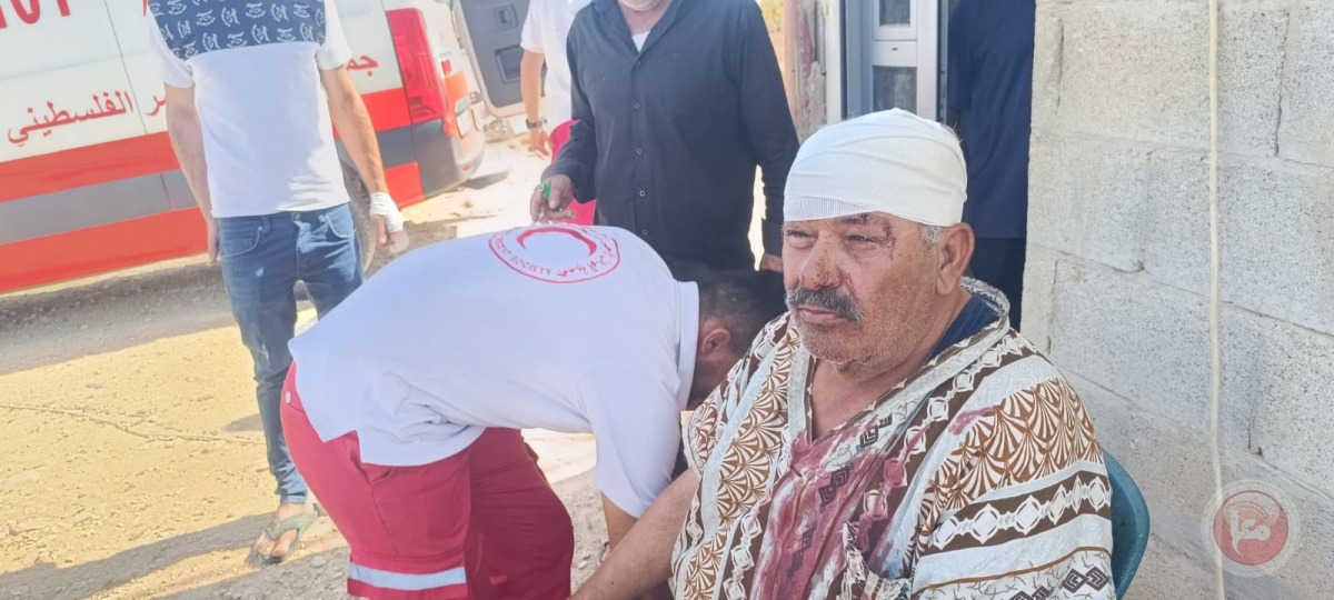 عصابات المستوطنين تعتدي على مواطنين في مسافر يطا