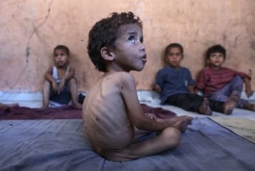 خلال يوم.. 5 حالات وفاة نتيجة سوء التغذية في قطاع غزة