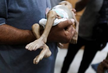 من بينهم 3 أطفال- 5 حالات وفاة نتيجة المجاعة خلال يوم في قطاع غزة