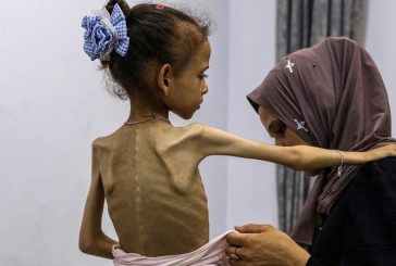 6 حالات وفاة بسبب سوء التغذية والمجاعة في غزة