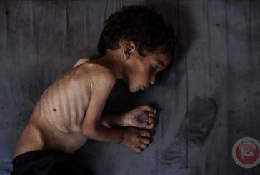 6 وفيات جديدة بسبب التجويع بغزة خلال 24 ساعة