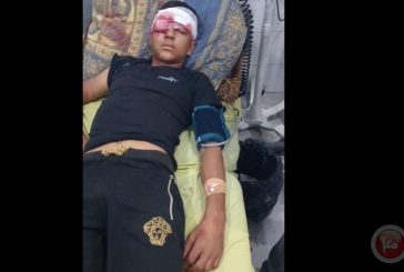 إصابة طالب بجروح خطيرة جراء قنبلة صوتية أطلقها الاحتلال غرب دورا