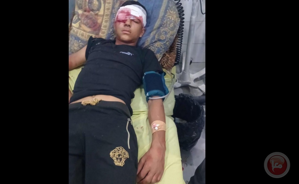 إصابة طالب بجروح خطيرة جراء قنبلة صوتية أطلقها الاحتلال غرب دورا