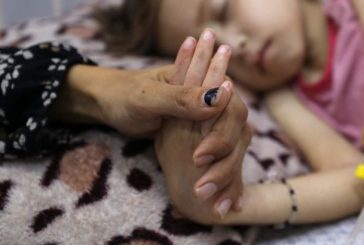 وفاتان نتيجة المجاعة وسوء التغذية بغزة