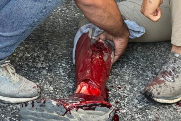 الخليل: إصابة شاب برصاص الاحتلال ومصادرة معدات من الجمعية الخيرية الإسلامية