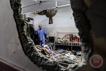 170 ألف جريج بحاجة لعمليات جراحية بغزة