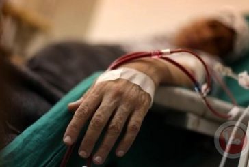 أمراض الكلى المزمنة.. تاسع سبب للوفاة عالميا و788 مليون مصاب