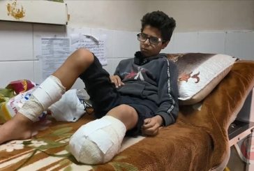 صحة غزة: 6 آلاف حالة بتر بحاجة إلى برامج تأهيل طويلة