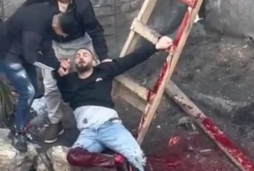 إصابة شاب برصاص الاحتلال في الرام شمال القدس