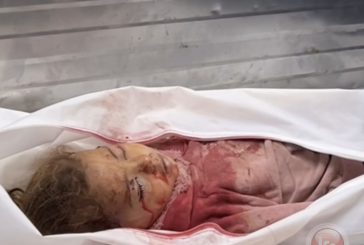 شهيدة واصابات في تجدد الغارات على قطاع غزة