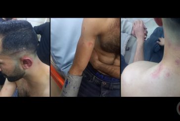 3 إصابات جراء اعتداء قوات الاحتلال غرب سلفيت