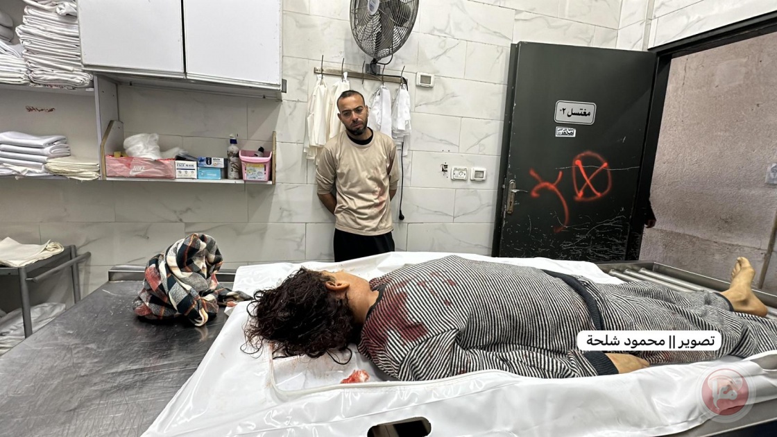 شهداء واصابات بغزة وجباليا والاحتلال يطلق الرصاص على طول الخط الأصفر