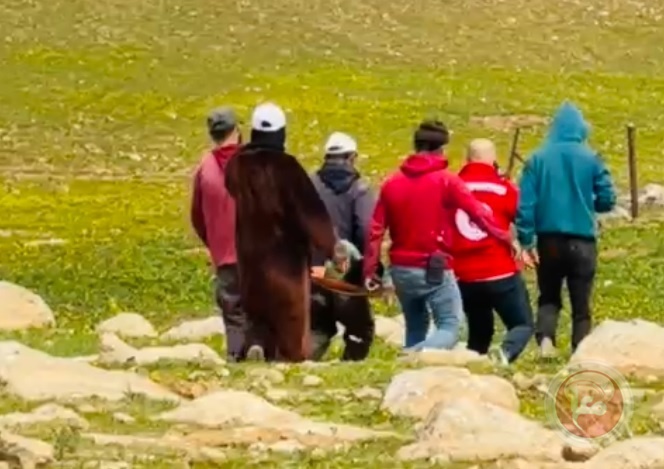 إصابة 3 أطفال واعتقالات خلال هجوم للمستوطنين في مسافر يطا
