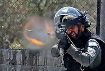 إصابة حرجة برصاص الاحتلال في مخيم الجلزون