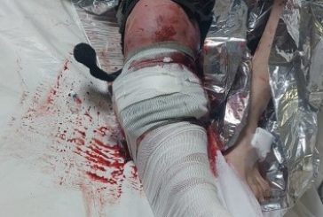 إصابة راعٍ برصاص الاحتلال في دير بلوط