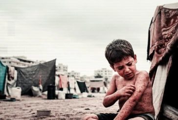الأونروا تحذر من تفاقم الأمراض الجلدية في غزة